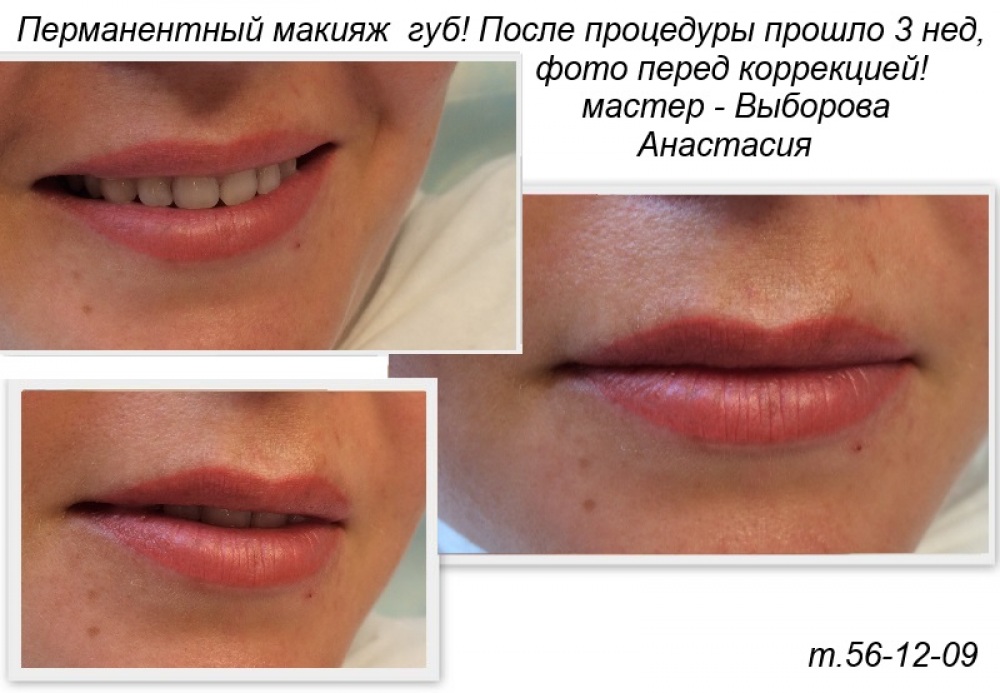 Магазин масок M ВКонтакте ЛЕКЦИЯ 7. Грыжи живота / Хирургические